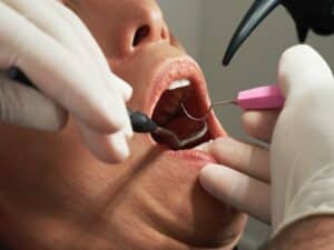 Front tooth replacement options