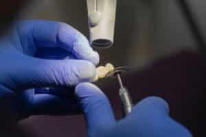Types of complete denture