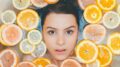 Home remedies for blackhead - girl