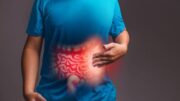 Is Apple Good For Acid Reflux?