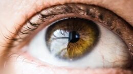 how to get rid of red eyes without eye drops