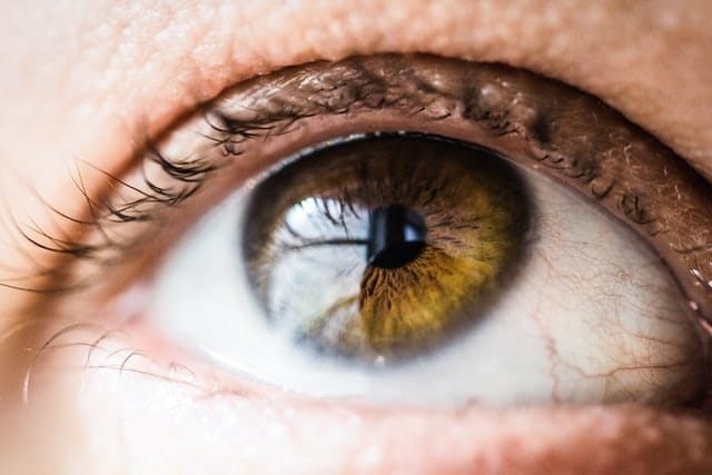 how to get rid of red eyes without eye drops