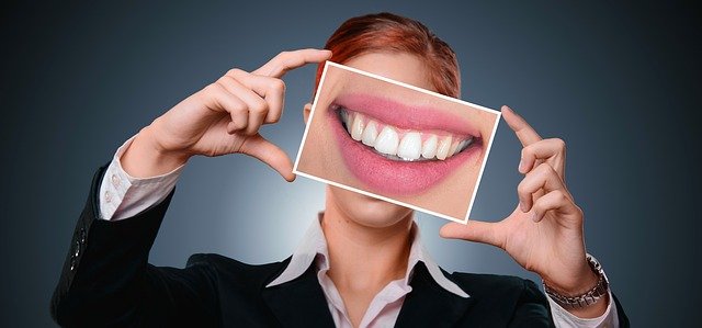 Process of Getting Veneers