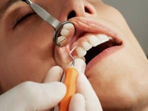 Process of getting veneer