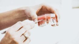 Types of Dental Bone Grafts