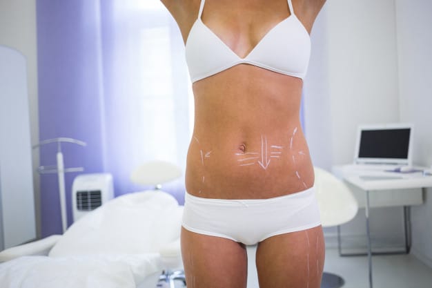 What Is Mommy Makeover? – Experience the Change