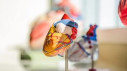 How to Become a Cardiac Sonographer