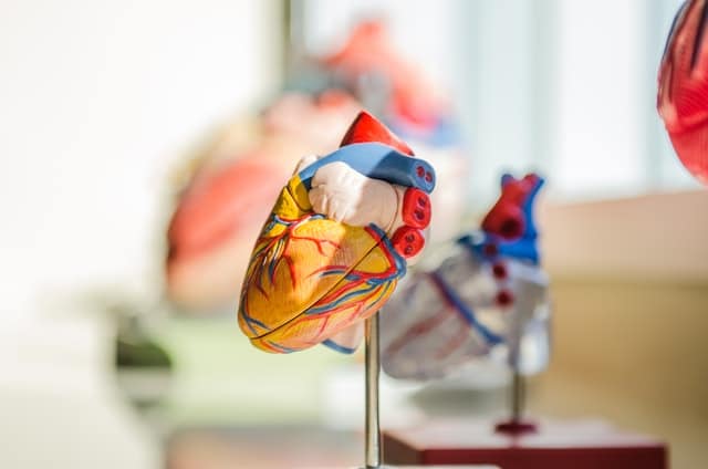 How to Become a Cardiac Sonographer