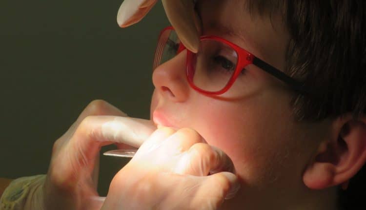 How Much do Braces Cost Without Insurance How Much Do Braces Cost Without Insurance? - Learn More!
