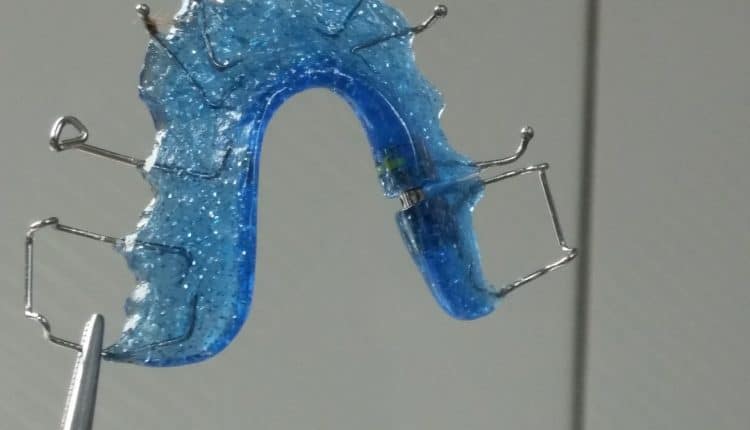 How Much do Braces Cost Without Insurance How Much do Braces Cost Without Insurance? - Afford the Cost of Treatment