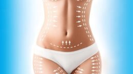 mommy makeover recovery time