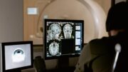 Teleradiology Services
