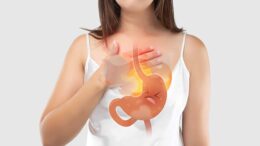 Acid Reflux Food Triggers